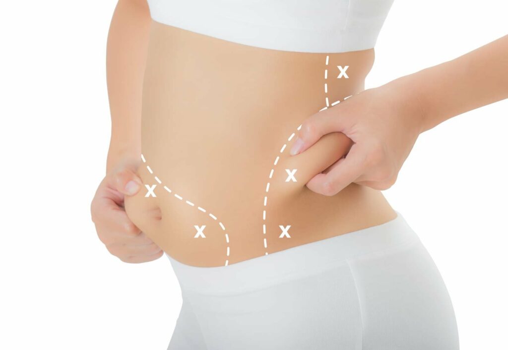 Body Sculpting & Fat Reduction treatment