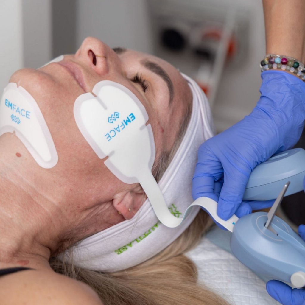 Beautilase technician performing EMFACE double chin removal nz treatment for visible chin reduction.